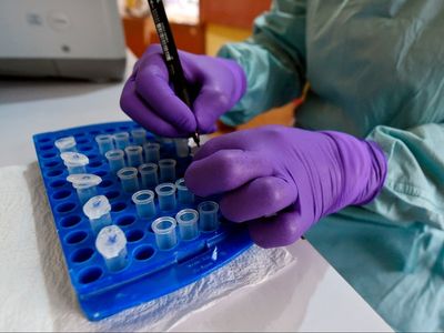 Lassa fever: First death confirmed in UK from new outbreak
