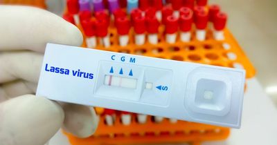 Lassa fever: What are the symptoms amid reports of two confirmed UK cases
