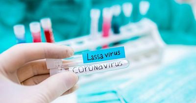 First person in UK dies of rare virus Lassa Fever with two other cases confirmed