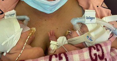 Tiny twins born the size of a Mars Bar with ZERO chance of survival thriving 111 days on