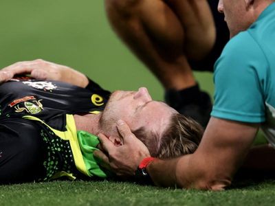 Concussed Steve Smith out of T20I series
