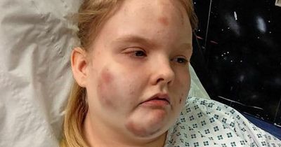 Lanarkshire schoolgirl left with horrific injuries after being restrained by teachers in classroom