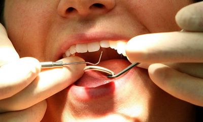 Tell us your experiences of accessing NHS dental care?