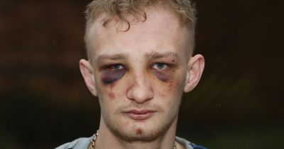'Screaming' Leeds man claims he was beaten up by police and 'thought he was going to die'