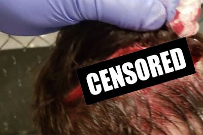 Hunter Boone mutilates head in alleged cage malfunction; promotion unsure of cause