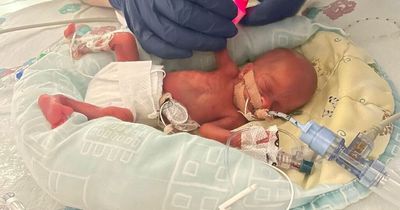 Mum finally hugs UK's smallest ever premature baby after being told she won't survive