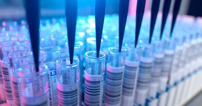 Scientists 'cure' female HIV patient for first time using stem cell transplant