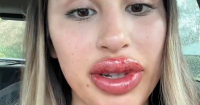 Woman shares her 'lip blush tattoo' - but beauty fans are very concerned by results