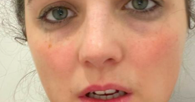 Storm Huntley posts 'the face of early pregnancy' with honest no make-up sickness pic