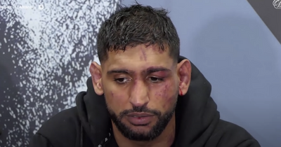 Amir Khan shows off facial injuries after brutal defeat at the hands of Kell Brook