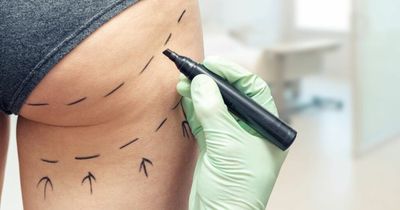 Concern at numbers of cosmetic surgery tourists admitted to Irish hospitals after botched operations