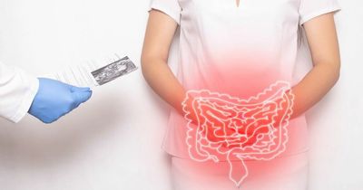 Bowel cancer: Two symptoms that may be early signs of the disease