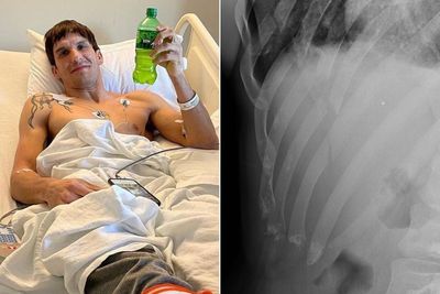 Chance Rencountre hospitalized for punctured lung, broken ribs from Andrey Koreshkov’s Bellator 274 kick