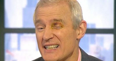 Jeremy Vine returns to work with a nasty black eye after penny-farthing accident