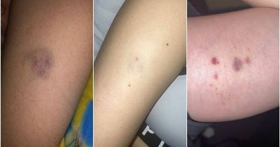 Three students say they were 'wiped out by spike injections' while on night out