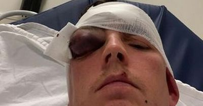 Footballer rushed to hospital after horror ‘headbutt’ from Lanarkshire player during amateur clash