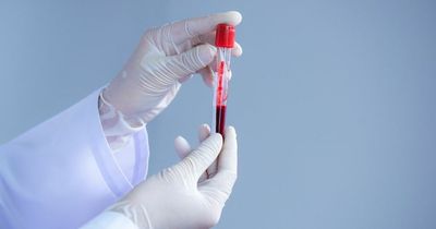 Simple blood test can show patient's fatal heart attack risk in next three years