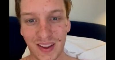 George Ezra forced to cancel Manchester gig after falling ill with chicken pox