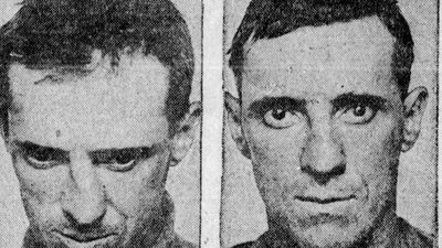 Prisoner plastic surgery was free for nearly 90 years in the US until a public outcry stopped it