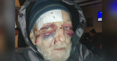Horrific alleyway attack leaves homeless man needing 14 stitches