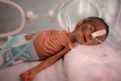 UN food agency says 13 million Yemenis may face starvation