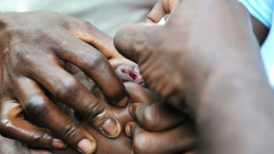 Malawi to launch polio immunization campaign after one case found