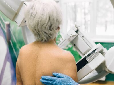 Breast cancer screening uptake at its lowest point in history