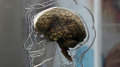 First Recording Of A Dying Human Brain Points To Memory Flashbacks