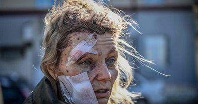 Death toll of people killed in Ukraine on the rise as casualties begin to soar