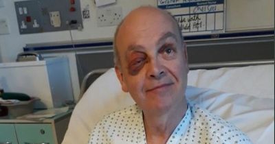 Man's incredible recovery after being hit by a bus in Leeds and left unconscious for three days