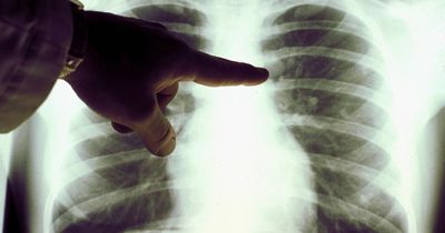 Lung disease symptoms as UK death rates are one of highest in Europe