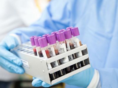 Why Aurinia Pharmaceuticals Shares Are Falling Today