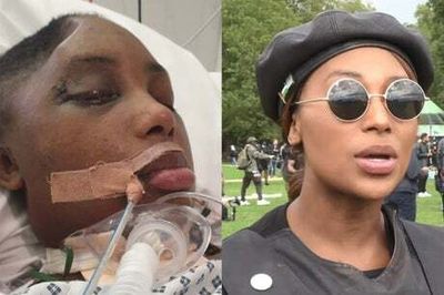 First picture of shot activist Sasha Johnson in hospital as family make emotional appeal