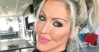 Woman burnt alive by jealous attacker who broke in 'proud' of scars 10 years on