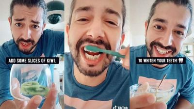 TikTokers Are Rubbing Kiwi & Cukes On Their Teeth To Whiten Them & Dentists Say They’re Right