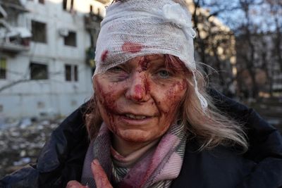 Ukraine war photojournalist Wolfgang Schwan: ‘My picture of Olena is terrible to look at but had to be taken’