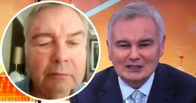 GB News' Eamonn Holmes startles fans after sharing alarming photo online