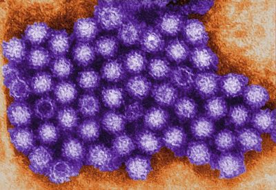 Rising number of norovirus cases in nurseries and care homes