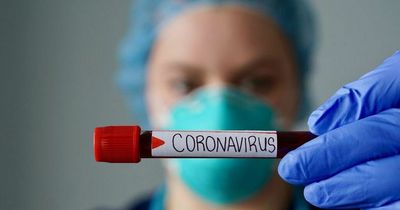 Scottish Government confirms 36 deaths and 9,491 covid cases in last 24 hours