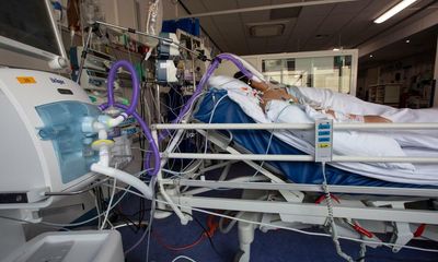 Arthritis drug could help save Covid patients – study