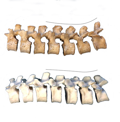 Neanderthal spine study sheds light on back pain and related ailments in humans