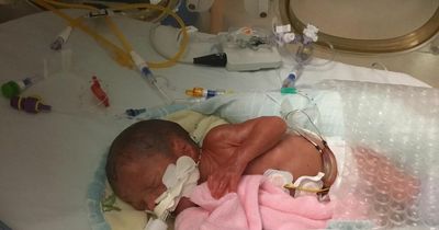 Tiny baby born weighing 'little more than can of Coke' fighting for her life