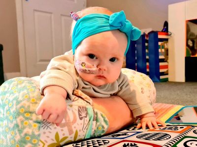 Toddler with brain tumour ‘hours from death’ after doctors dismissed swollen head as ‘normal baby stuff’