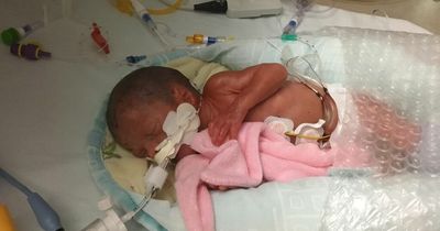 Tiny premature baby as 'big as can of Coke' fighting for life in hospital