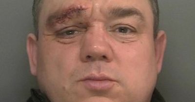 Girlfriend calls 999 and whispers 'I need help' after dangerous thug breaks eye socket