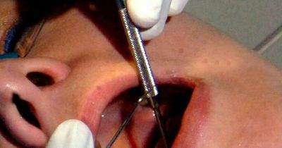 MSP hits out over 'completely unacceptable' backlog of dental appointments in Lanarkshire