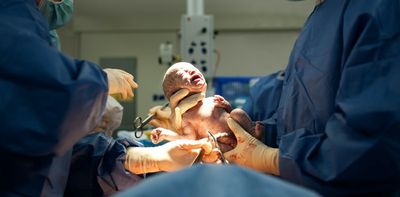 Private obstetric care increases the chance of caesarean birth, regardless of health needs and wishes