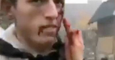 Crisis actors, fake bodies and wooden guns - lies claiming Ukraine war is hoax