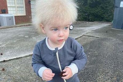 US boy with rare uncombable hair syndrome now an Instagram sensation
