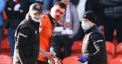 Ellis Simms' challenge slammed by Dundee United's Calum Butcher after Hearts striker broke Ryan Edwards' nose